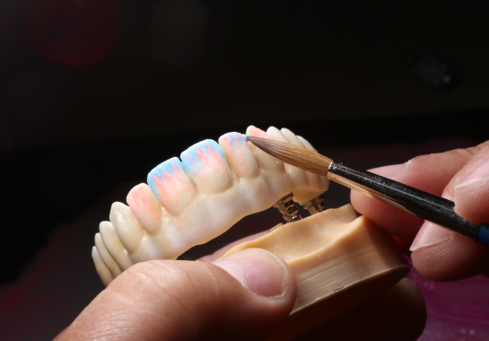 La fabrication d'implants dentaires